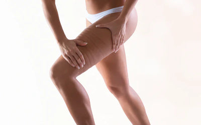 CelluSculpt™ | Oplev en synligt glattere og strammere hud